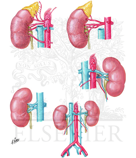 Watermarked preview of unlabeled image: Variations in Renal Artery and Vein