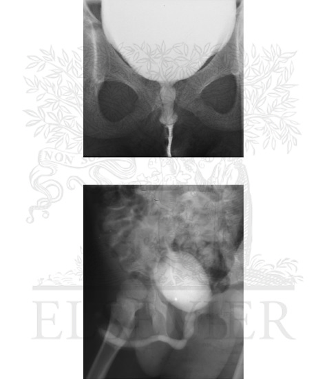 Male and Female Cystourethrograms
