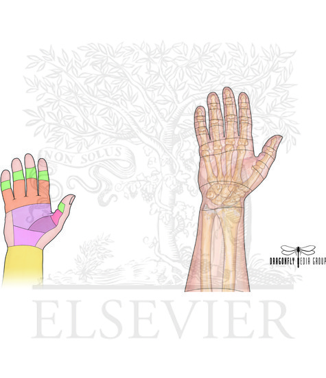 Flexor and Extensor Zones of Hand