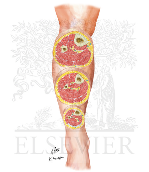 Leg: Serial Cross Sections