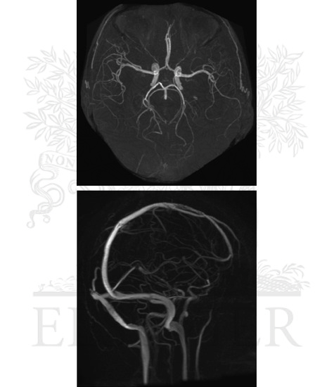Cranial Imaging  (MRA and MRV)