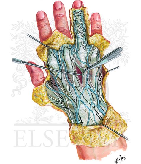 Wrist and Hand: Superficial Dorsal Dissection