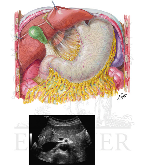 Stomach in Situ