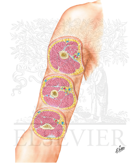 Arm: Serial Cross Sections