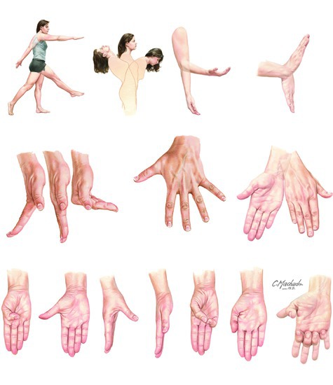 Terms of movement 