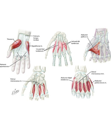 Watermarked preview of unlabeled image: Muscles of the Hand