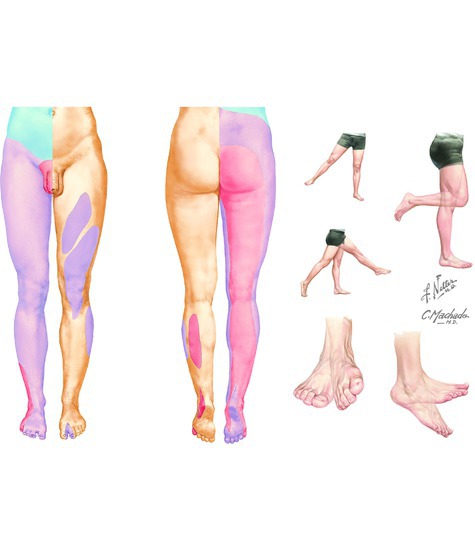 Segmental Sensory Innervation (Dermatomes) of the Lower Limb