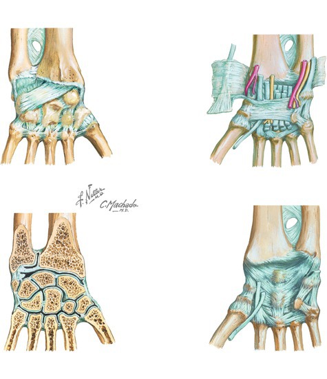Ligaments of the Wrist