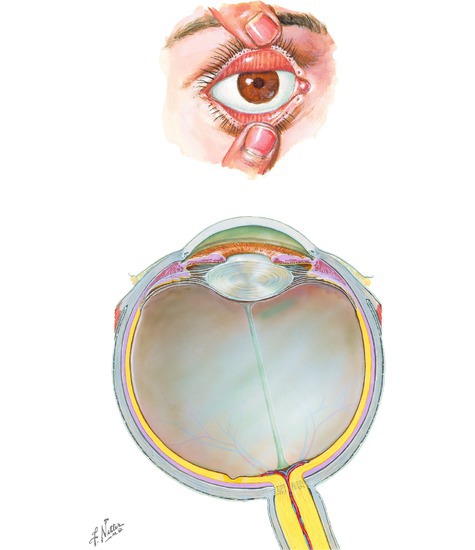 Eye
