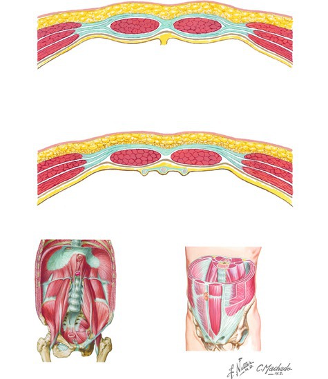 Muscles of the Trunk