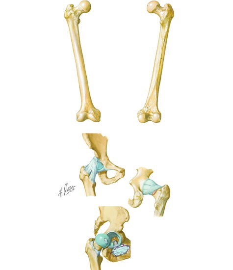 Osteology of the Thigh and Hip