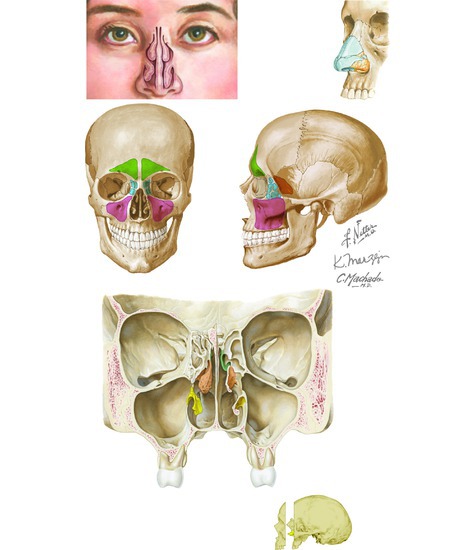Nasal Skeleton and Paranasal Sinuses