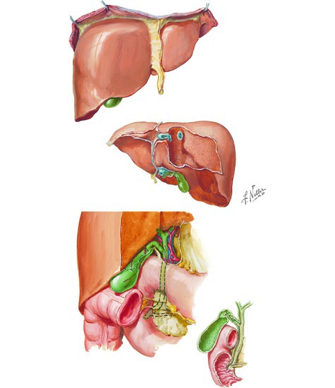 Watermarked preview of unlabeled image: Liver and Biliary System
