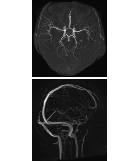 Cranial Imaging  (MRA and MRV)