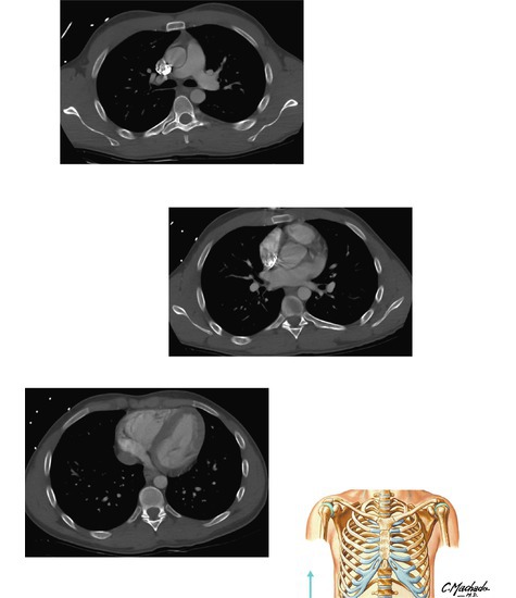 Chest Scans: Axial CT Images