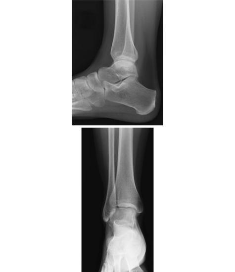 Watermarked preview of unlabeled image: Ankle: Radiographs