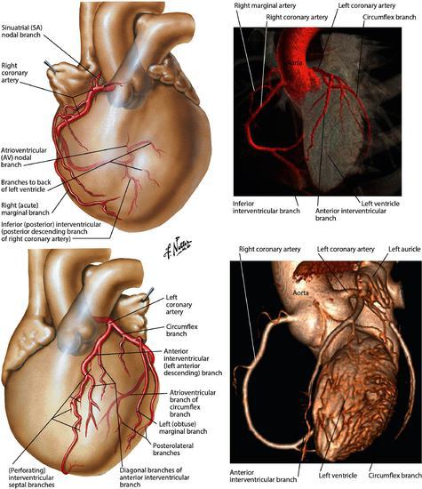 Coronary Arteries: Imaging