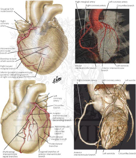 Coronary Arteries: Imaging