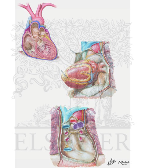 Pericardial Sac and Pericardial Cavity