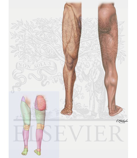 Surface Anatomy of Lower Limb