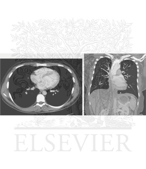 Computed tomography (CT) and magnetic resonance imaging (MRI)