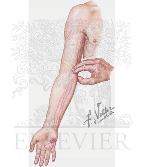 Watermarked preview of unlabeled image: Lymphadenopathy