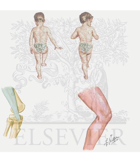 Trendelenberg Test and Iliotibial Tract Band Syndrome