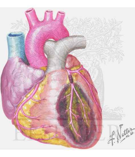 Coronary Artery Disease (CAD)