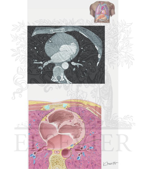 Imaging of the Heart (Axial CT Scan of Heart)