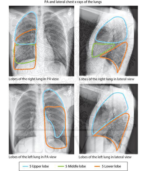 PA and Lateral X-Rays: Superimposed Outlines of Lung Lobes