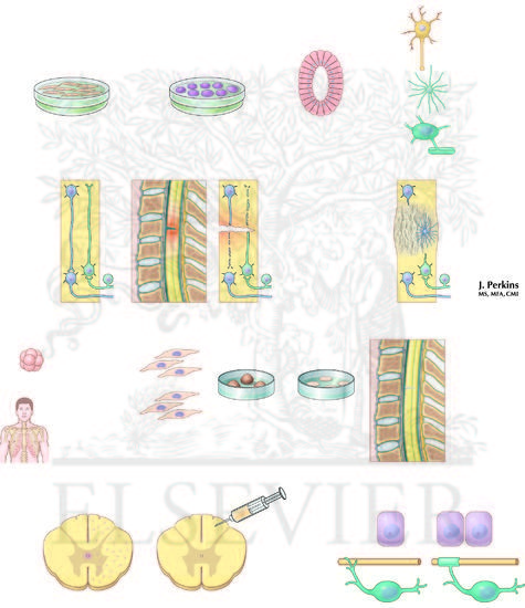 Watermarked preview of unlabeled image: Stem Cell Therapy
