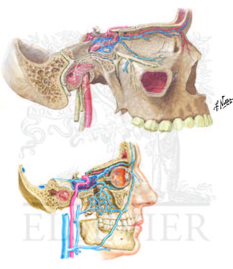 Internal Carotid and Ophthalmic Artery Course and Cavernous Sinus Fistula