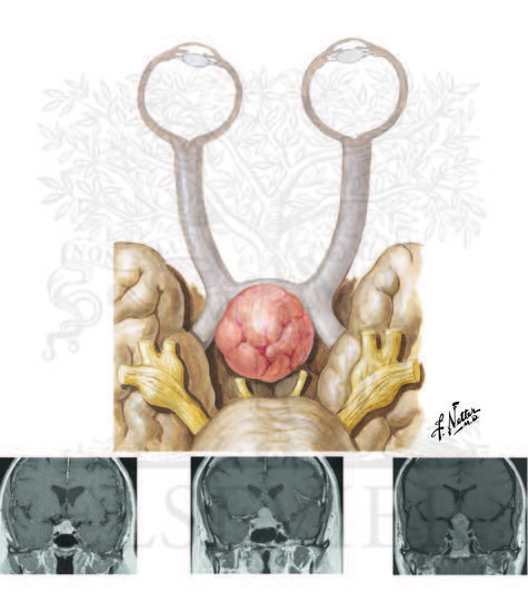 Watermarked preview of unlabeled image: Anatomy of Taste Buds and Their Receptors