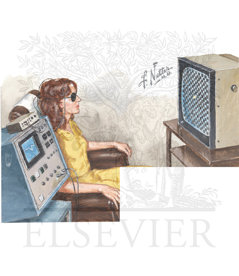Visual Evoked Response (VER)