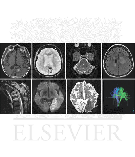 Different magnetic resonance imaging sequences accentuate the differences that tissue injury or disease creates within the central nervous system