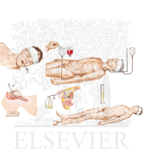 Initial Management of Coma and Severe Head Injuries
