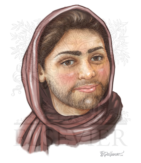 Hirsutism