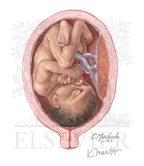 Fetus