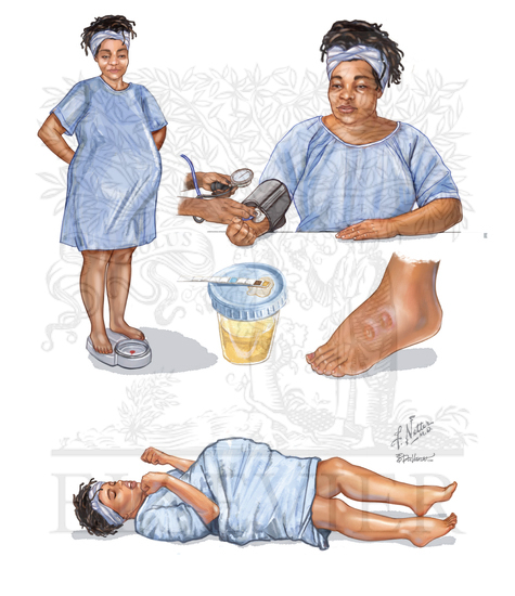 Pregnancy