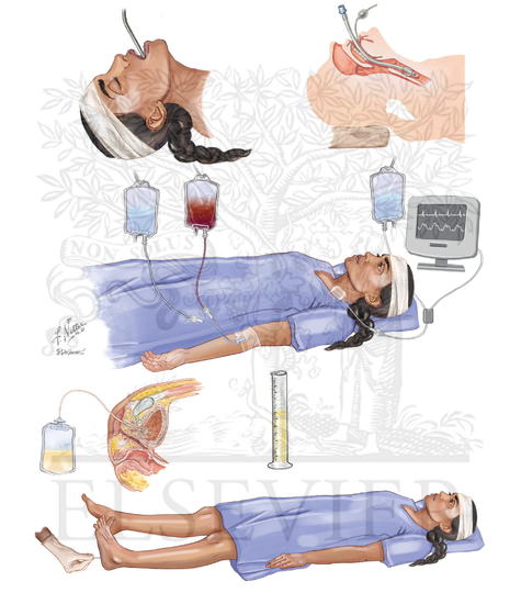 Watermarked preview of unlabeled image: Head Trauma With Bandage: Initial Assessment and Management 