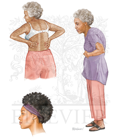 Watermarked preview of unlabeled image: Female (III)