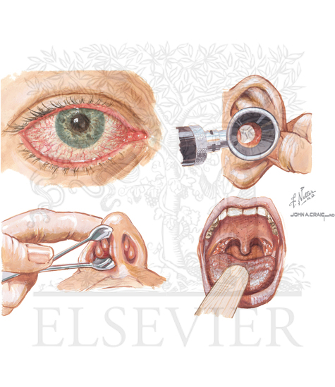 Components of physical examination in allergic rhinitis