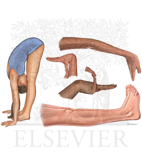 Beighton criteria for hypermobility 