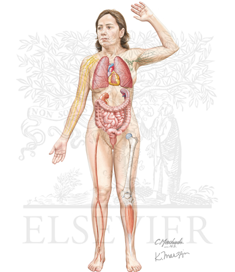 Systemic Manifestations of Rheumatoid Arthritis