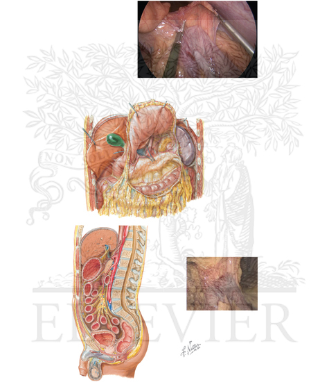 Greater omentum and stomach