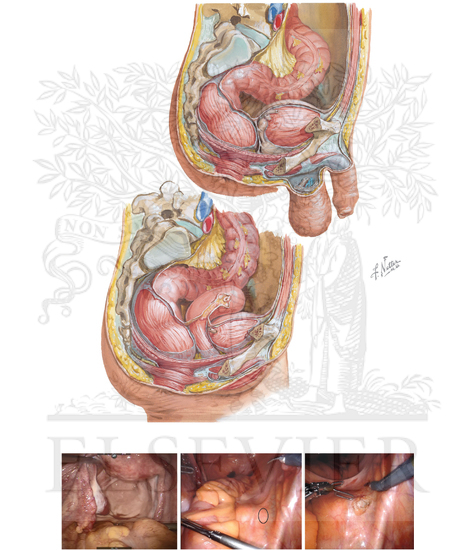 Anatomy for rectopexy and pelvic dissection