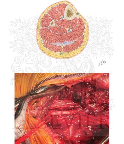 Anatomy of lower leg and posterior tibial artery control