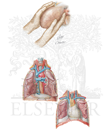 Watermarked preview of unlabeled image: Cardiac massage, left thoracotomy, and ligament incision