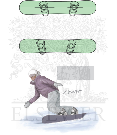 Watermarked preview of unlabeled image: Snowboard stance