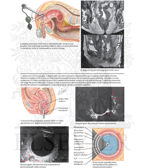 Proctoscopy and endorectal ultrasonography